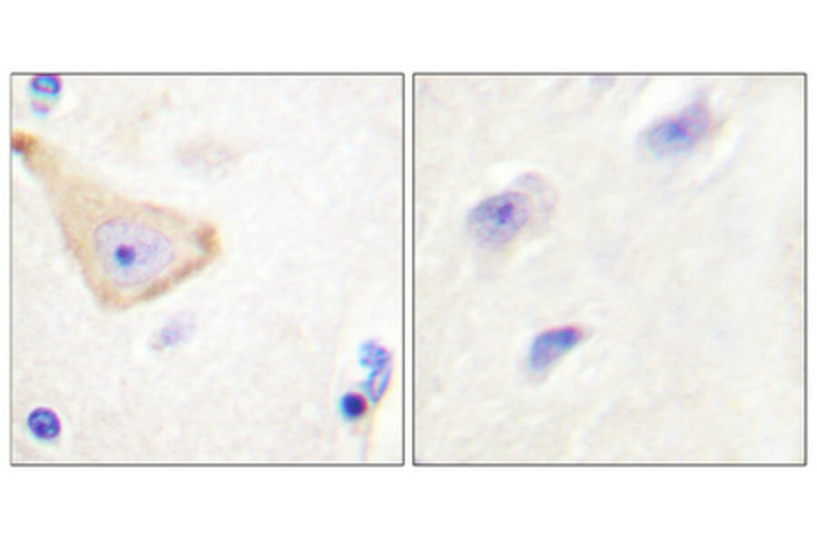 Immunohistochemistry - Anti-IL-3R beta (phospho Tyr593) Antibody (A0444) - Antibodies.com