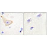 Immunohistochemistry - Anti-IL-3R beta (phospho Tyr593) Antibody (A0444) - Antibodies.com