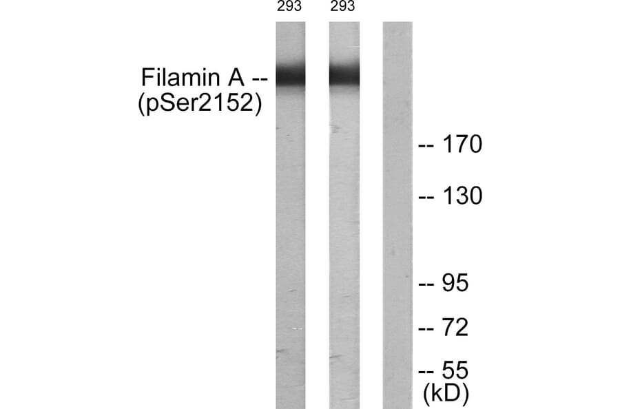 Western Blot - Anti-Filamin A (phospho Ser2152) Antibody (A0072) - Antibodies.com