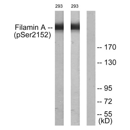 Western Blot - Anti-Filamin A (phospho Ser2152) Antibody (A0072) - Antibodies.com