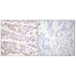 Immunohistochemistry - Anti-Filamin A (phospho Ser2152) Antibody (A0072) - Antibodies.com