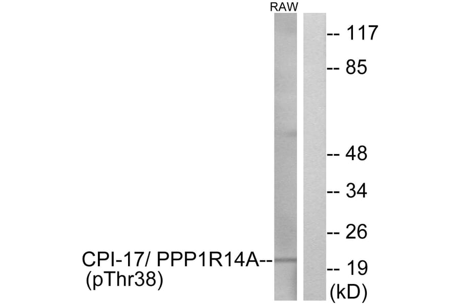 Western Blot - Anti-CPI17 alpha (phospho Thr38) Antibody (A7051) - Antibodies.com