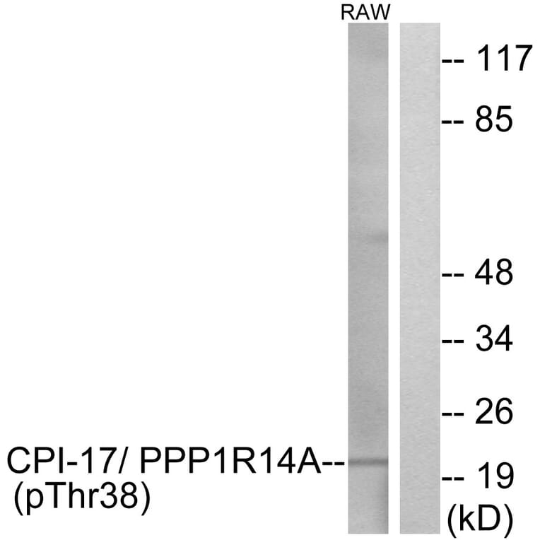 Western Blot - Anti-CPI17 alpha (phospho Thr38) Antibody (A7051) - Antibodies.com