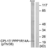 Western Blot - Anti-CPI17 alpha (phospho Thr38) Antibody (A7051) - Antibodies.com