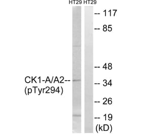 Western Blot - Anti-CK-1 alpha (phospho Tyr294) Antibody (A8088) - Antibodies.com