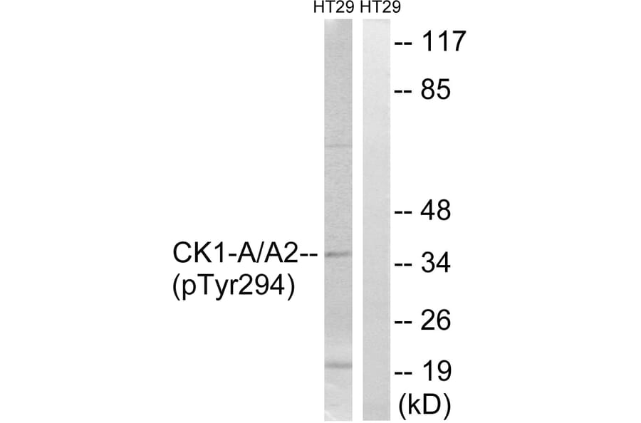Western Blot - Anti-CK-1 alpha (phospho Tyr294) Antibody (A8088) - Antibodies.com