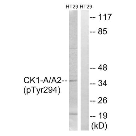 Western Blot - Anti-CK-1 alpha (phospho Tyr294) Antibody (A8088) - Antibodies.com