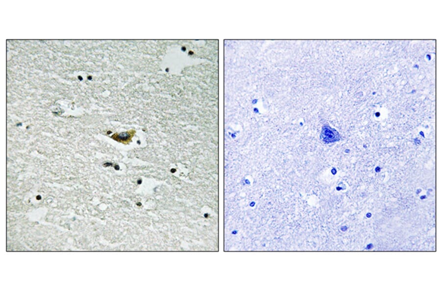 Immunohistochemistry - Anti-CK-1 alpha (phospho Tyr294) Antibody (A8088) - Antibodies.com
