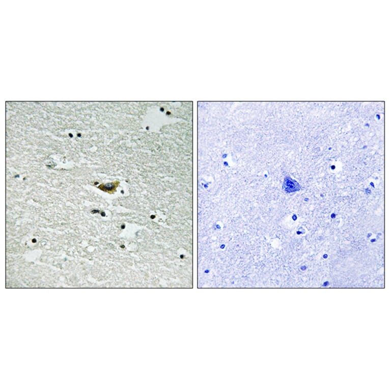 Immunohistochemistry - Anti-CK-1 alpha (phospho Tyr294) Antibody (A8088) - Antibodies.com