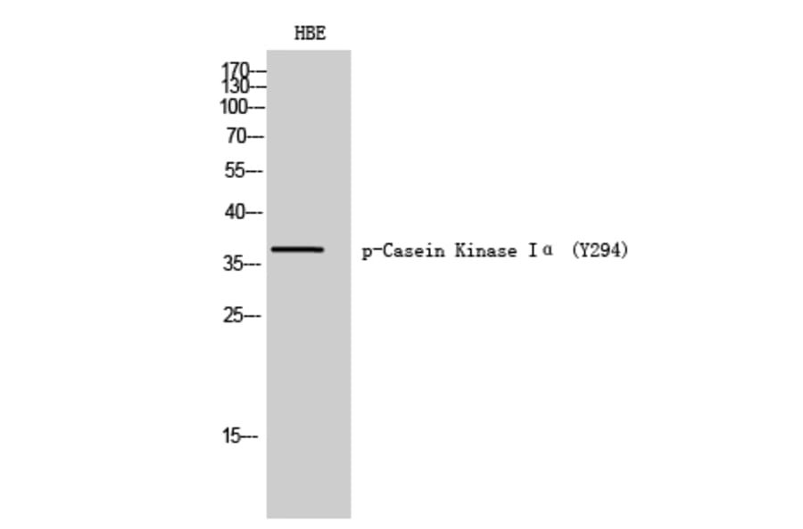 Western Blot - Anti-CK-1 alpha (phospho Tyr294) Antibody (A8088) - Antibodies.com