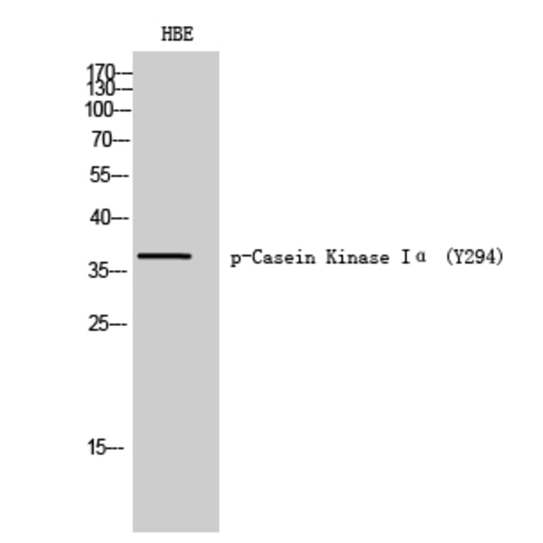 Western Blot - Anti-CK-1 alpha (phospho Tyr294) Antibody (A8088) - Antibodies.com