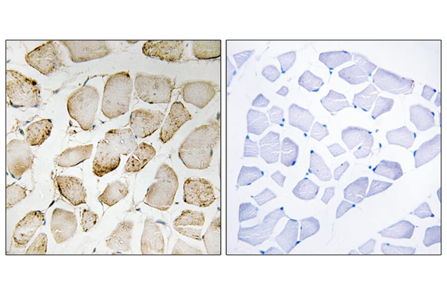 Immunohistochemistry - Anti-Arachidonate 5 Lipoxygenase Antibody (B0769) - Antibodies.com
