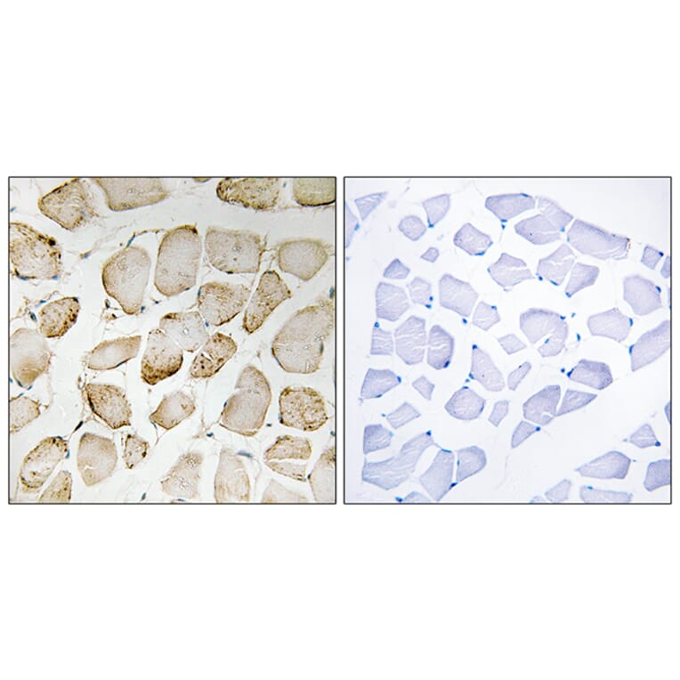 Immunohistochemistry - Anti-Arachidonate 5 Lipoxygenase Antibody (B0769) - Antibodies.com