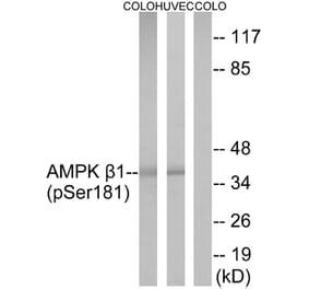 Western Blot - Anti-AMPK beta1 (phospho Ser181) Antibody (A0410) - Antibodies.com