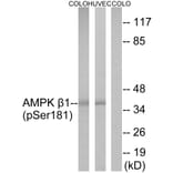Western Blot - Anti-AMPK beta1 (phospho Ser181) Antibody (A0410) - Antibodies.com