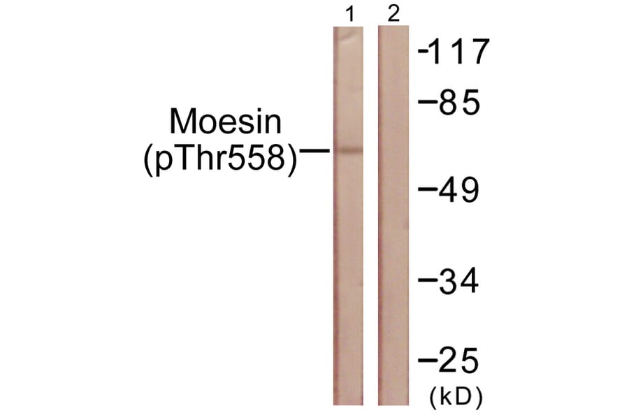 Western Blot - Anti-Moesin (phospho Thr558) Antibody (A1102) - Antibodies.com