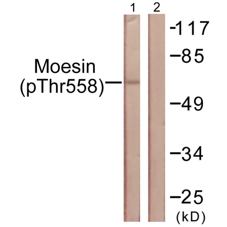 Western Blot - Anti-Moesin (phospho Thr558) Antibody (A1102) - Antibodies.com