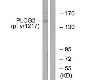 Western Blot - Anti-PLCG2 (phospho Tyr1217) Antibody (A0553) - Antibodies.com