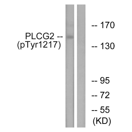 Western Blot - Anti-PLCG2 (phospho Tyr1217) Antibody (A0553) - Antibodies.com