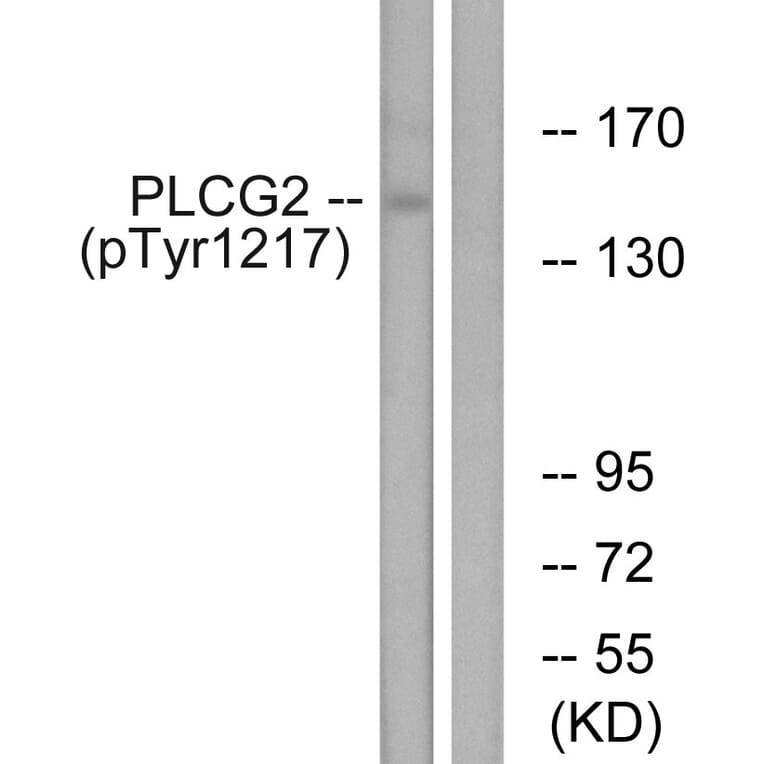 Western Blot - Anti-PLCG2 (phospho Tyr1217) Antibody (A0553) - Antibodies.com