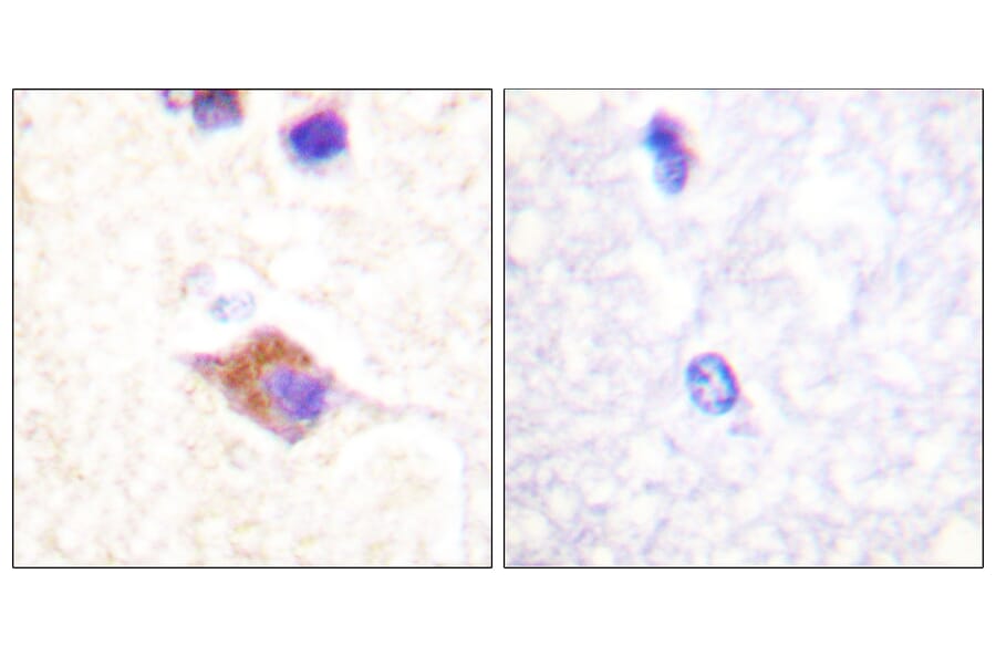 Immunohistochemistry - Anti-PLCG2 (phospho Tyr1217) Antibody (A0553) - Antibodies.com