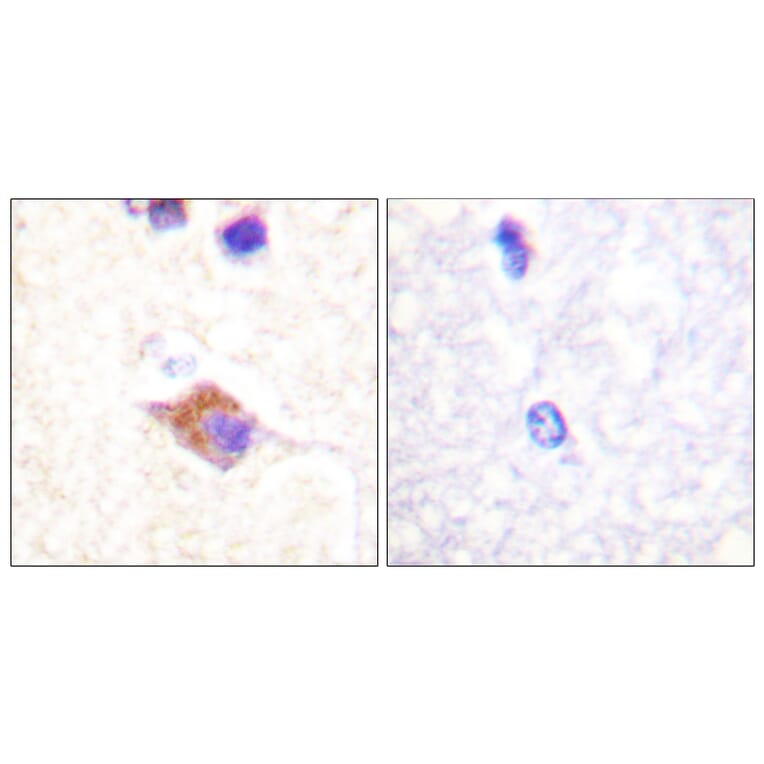 Immunohistochemistry - Anti-PLCG2 (phospho Tyr1217) Antibody (A0553) - Antibodies.com