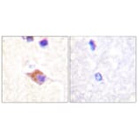 Immunohistochemistry - Anti-PLCG2 (phospho Tyr1217) Antibody (A0553) - Antibodies.com