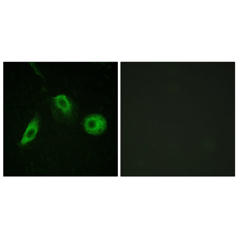 Immunofluorescence - Anti-PLCG2 (phospho Tyr1217) Antibody (A0553) - Antibodies.com