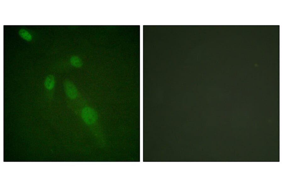 Immunofluorescence - Anti-Lys-Acetylated Proteins Antibody (D0020) - Antibodies.com