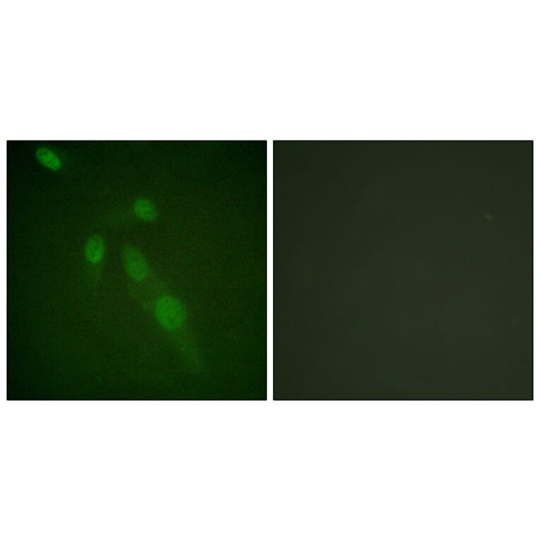 Immunofluorescence - Anti-Lys-Acetylated Proteins Antibody (D0020) - Antibodies.com