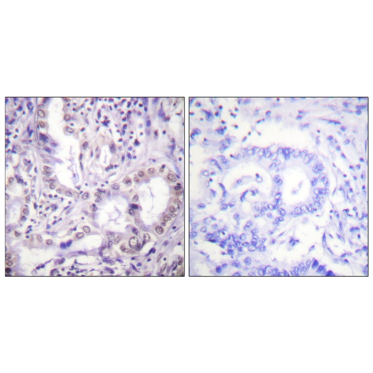 Immunohistochemistry - Anti-Lys-Acetylated Proteins Antibody (D0020) - Antibodies.com