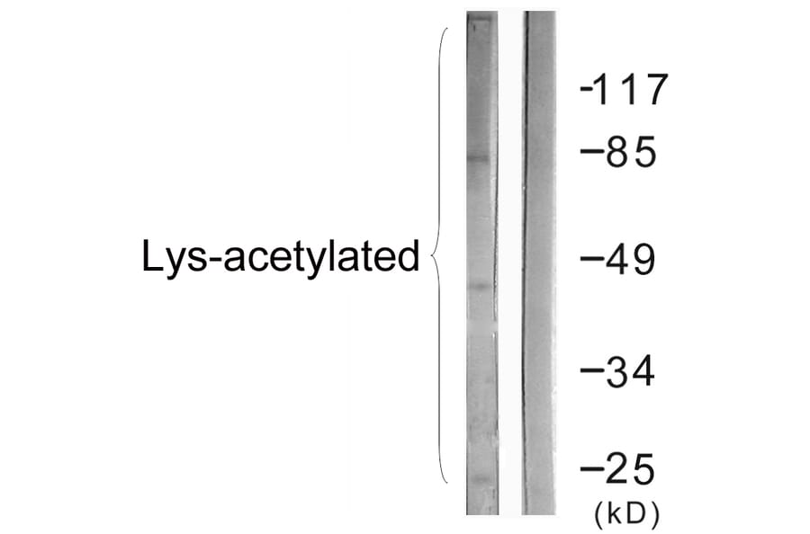Western Blot - Anti-Lys-Acetylated Proteins Antibody (D0020) - Antibodies.com