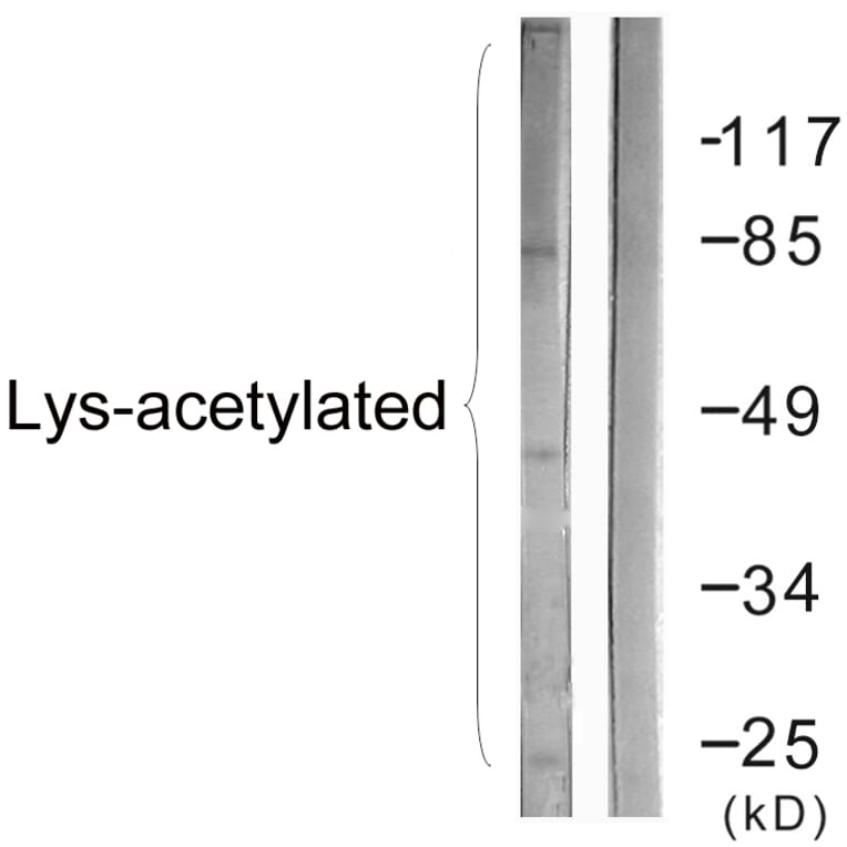 Western Blot - Anti-Lys-Acetylated Proteins Antibody (D0020) - Antibodies.com