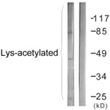 Western Blot - Anti-Lys-Acetylated Proteins Antibody (D0020) - Antibodies.com
