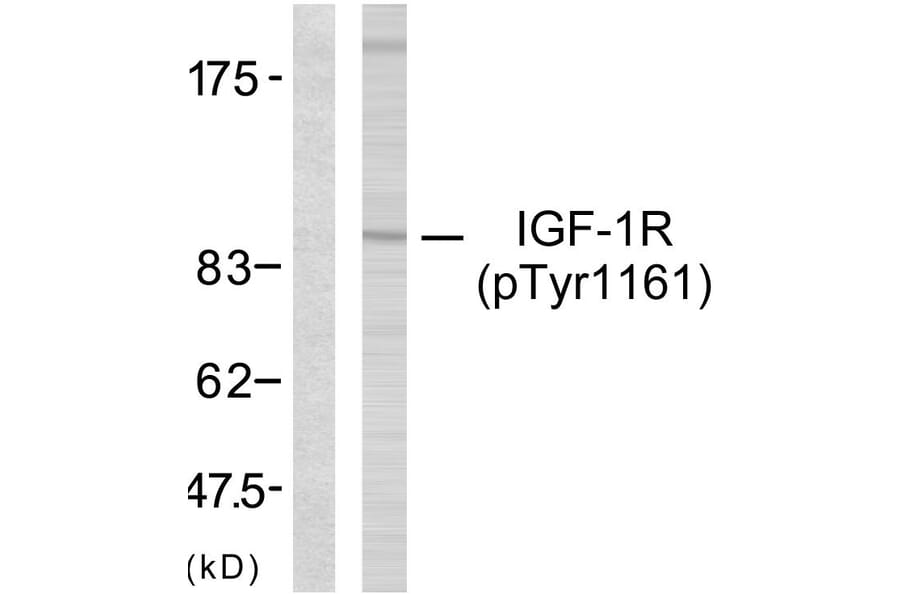 Western Blot - Anti-IGF1R (phospho Tyr1161) Antibody (A7114) - Antibodies.com