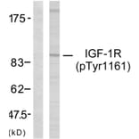 Western Blot - Anti-IGF1R (phospho Tyr1161) Antibody (A7114) - Antibodies.com