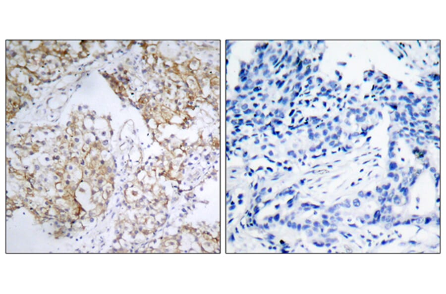 Immunohistochemistry - Anti-IGF1R (phospho Tyr1161) Antibody (A7114) - Antibodies.com