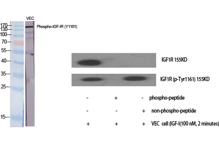 Western Blot - Anti-IGF1R (phospho Tyr1161) Antibody (A7114) - Antibodies.com