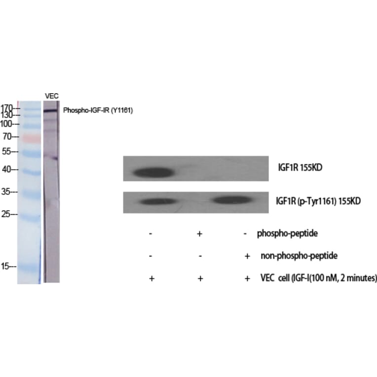 Western Blot - Anti-IGF1R (phospho Tyr1161) Antibody (A7114) - Antibodies.com