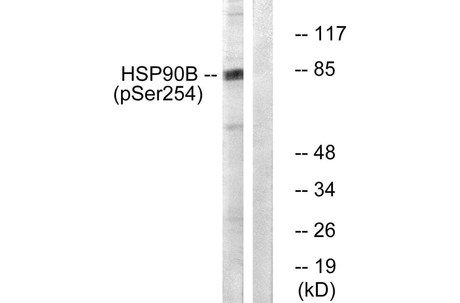 Western Blot - Anti-HSP90B (phospho Ser254) Antibody (A0013) - Antibodies.com