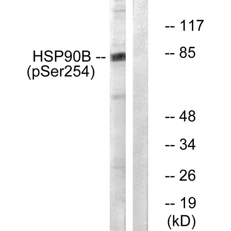 Western Blot - Anti-HSP90B (phospho Ser254) Antibody (A0013) - Antibodies.com