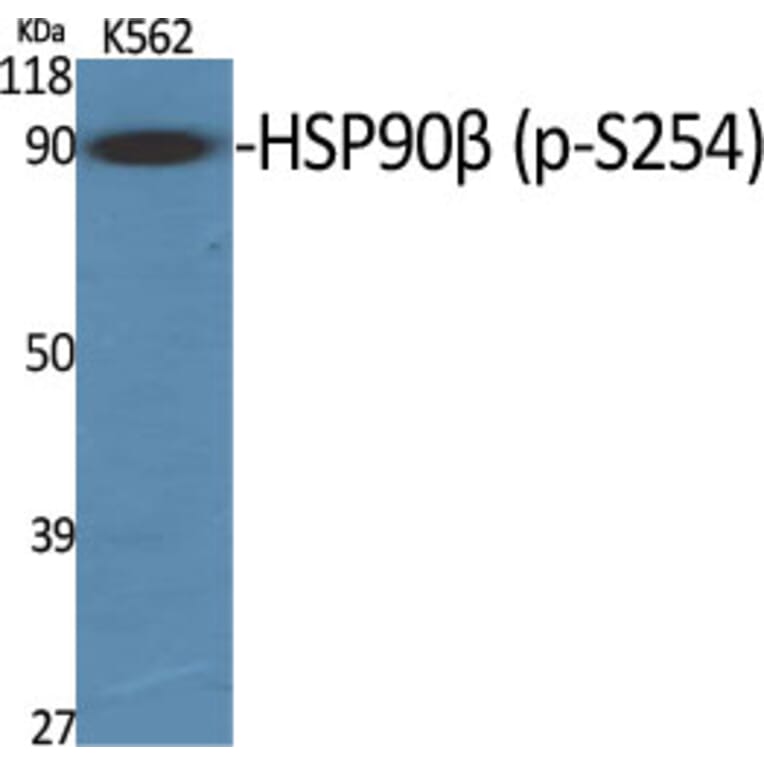 Western Blot - Anti-HSP90B (phospho Ser254) Antibody (A0013) - Antibodies.com
