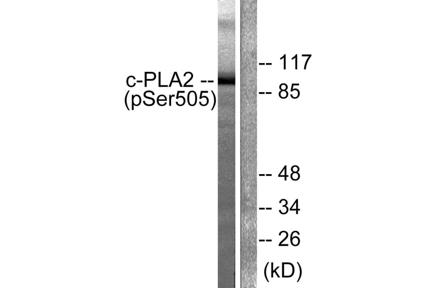 Western Blot - Anti-c-PLA2 (phospho Ser505) Antibody (A0065) - Antibodies.com