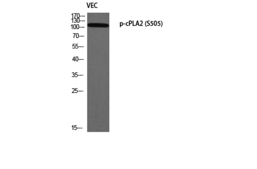 Western Blot - Anti-c-PLA2 (phospho Ser505) Antibody (A0065) - Antibodies.com