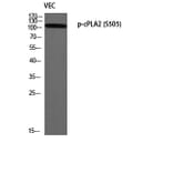 Western Blot - Anti-c-PLA2 (phospho Ser505) Antibody (A0065) - Antibodies.com