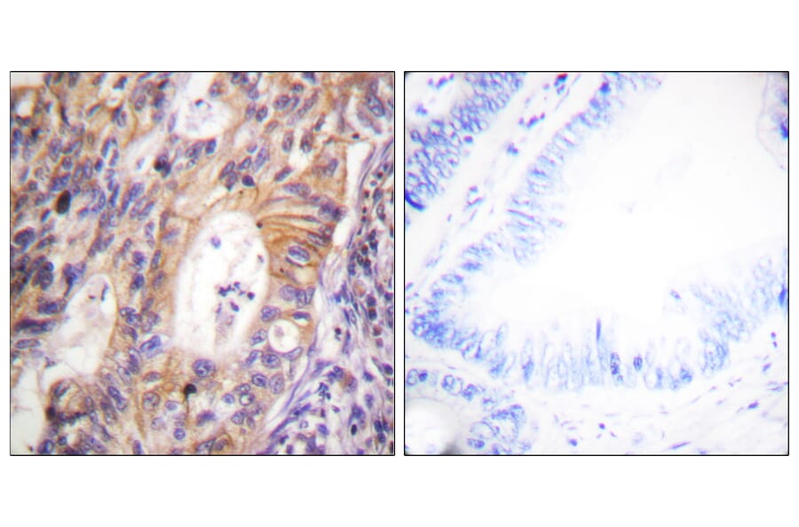 Immunohistochemistry - Anti-c-Met (phospho Tyr1003) Antibody (A0871) - Antibodies.com