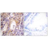 Immunohistochemistry - Anti-c-Met (phospho Tyr1003) Antibody (A0871) - Antibodies.com