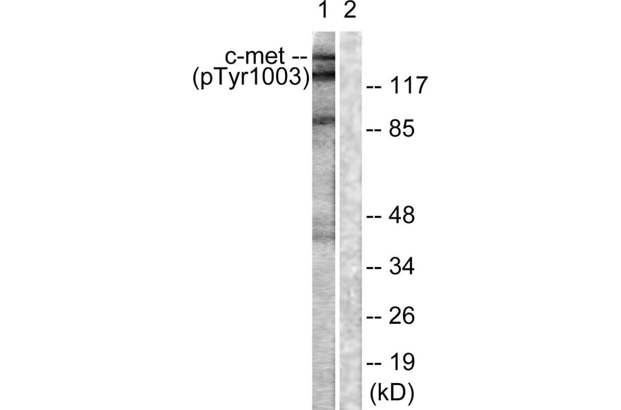 Western Blot - Anti-c-Met (phospho Tyr1003) Antibody (A0871) - Antibodies.com