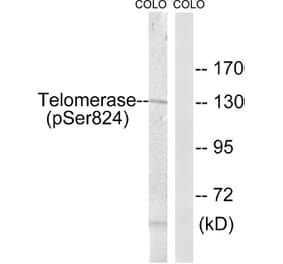 Western Blot - Anti-Telomerase (phospho Ser824) Antibody (A1183) - Antibodies.com