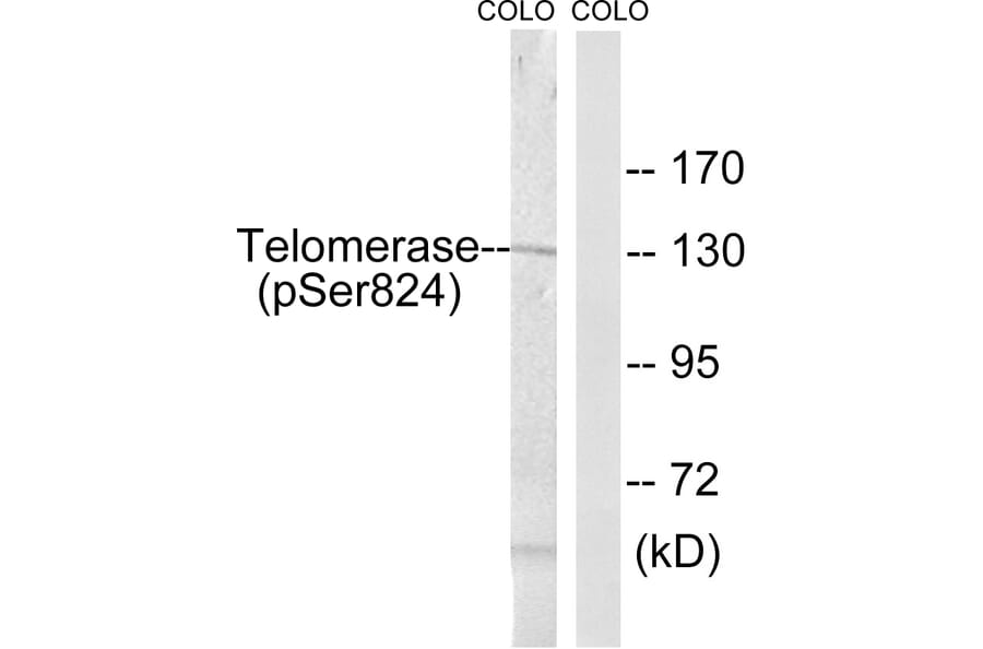 Western Blot - Anti-Telomerase (phospho Ser824) Antibody (A1183) - Antibodies.com